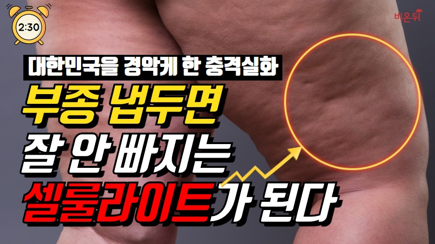 [2분 30초] 유독 안 빠지는 살은 부종때문? 부종 빼는 147스트레칭 법 