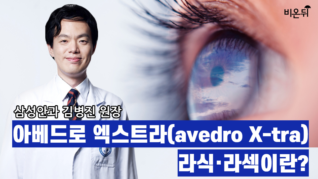 아베드로 엑스트라(avedro X-tra) 라식·라섹이란?