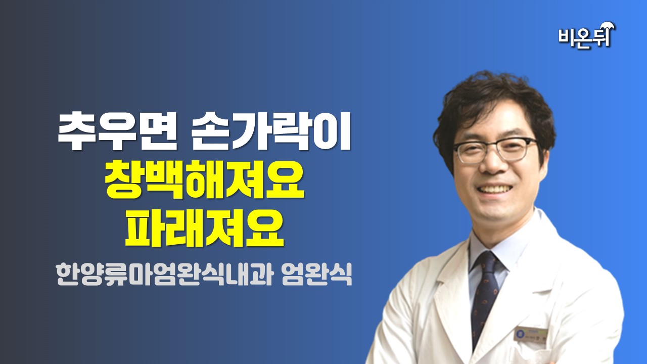 추우면 손가락이 창백해져요. 파래져요! (한양류마엄완식내과 엄완식)