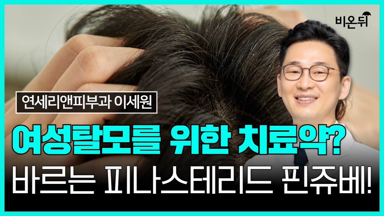 여성탈모를 위한 치료약? 바르는 피나스테리드 핀쥬베! / 연세리앤피부과 이세원