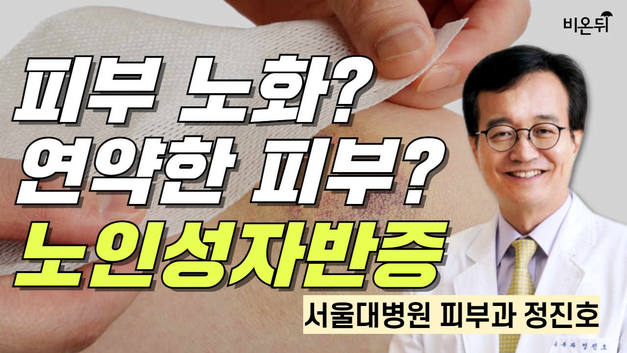 갑작스럽게 멍이 생겼다면? 피부 노화? 연약한 피부? 노인성자반증 / 서울대병원 피부과 정진호