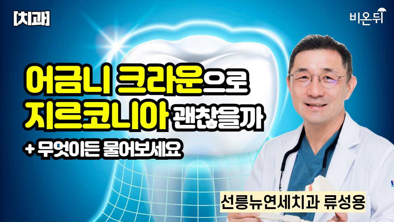 [치과] 어금니 크라운으로 지르코니아 괜찮을까 + 무엇이든 물어보세요 / 선릉뉴연세치과 류성용