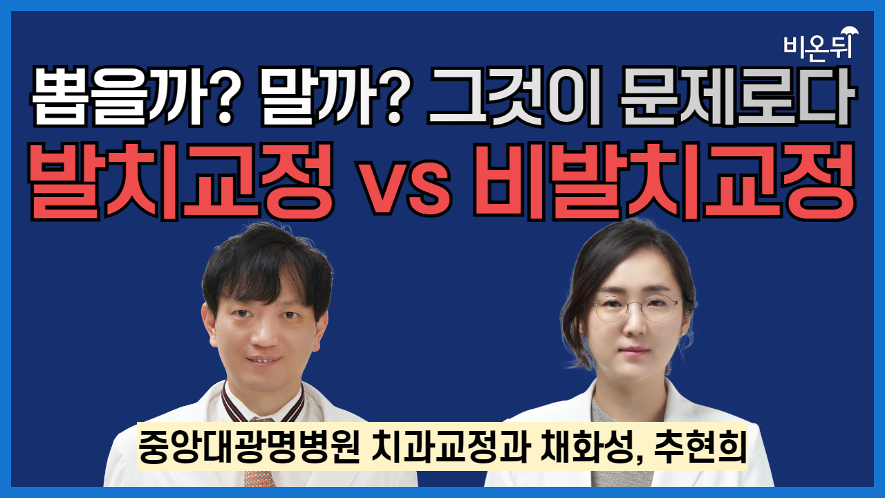 뽑을까? 말까? 그것이 문제로다(발치 교정 vs 비발치교정) / 중앙대광명병원 치과교정과 채화성, 추현희