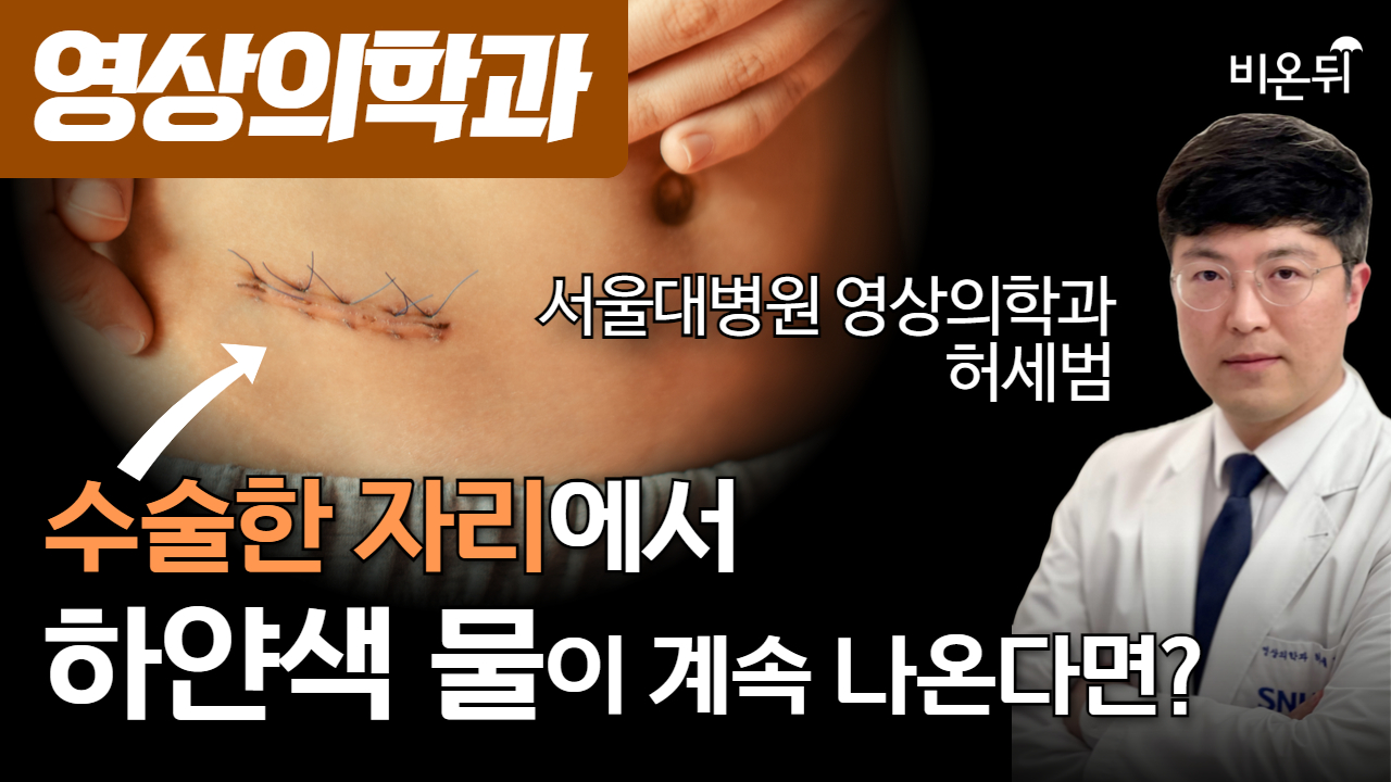 수술한 자리에서 하얀색 물이 계속 나온다면? / 서울대병원 영상의학과 허세범