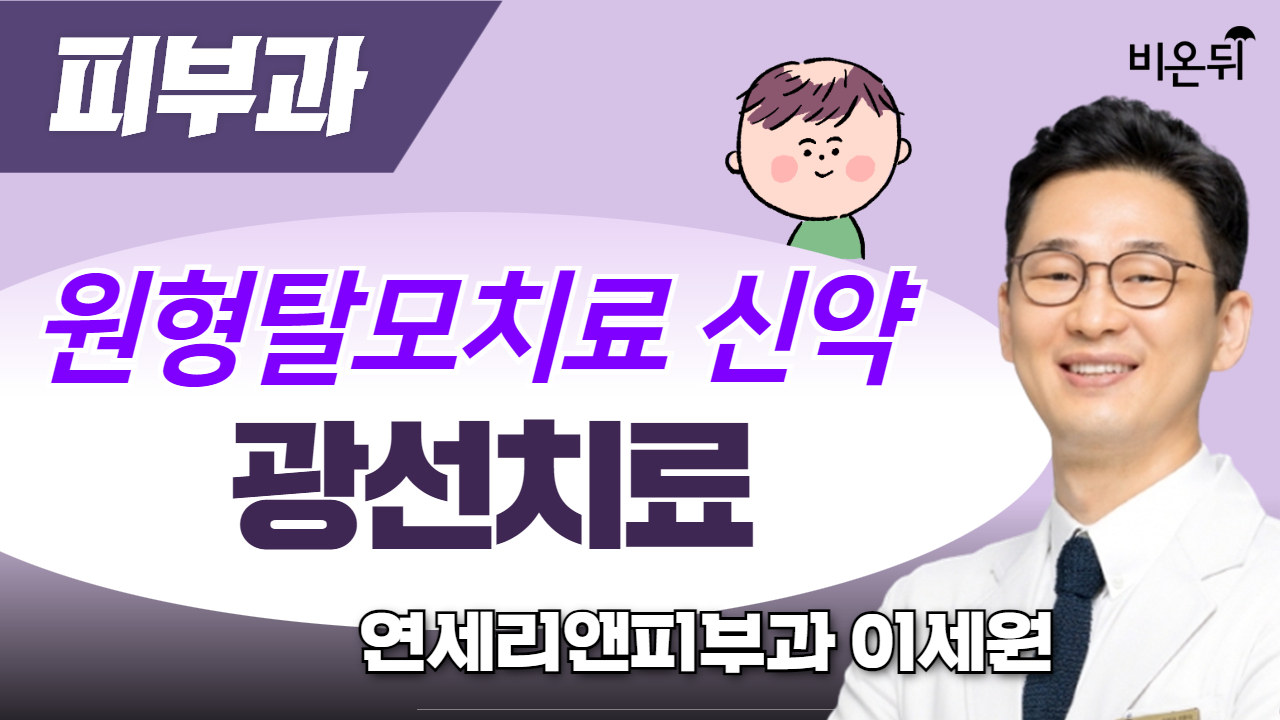 원형탈모치료신약, 광선치료 / 연세리앤피부과 이세원