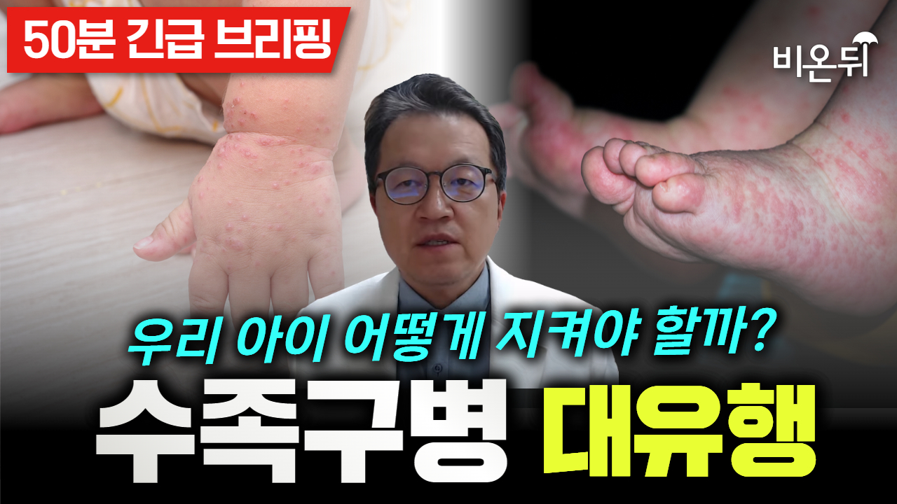 [시사이슈 라이브] 수족구병 대유행, 우리 아이 어떻게 지켜야 할까? / 창원파티마병원 소아청소년과 마상혁