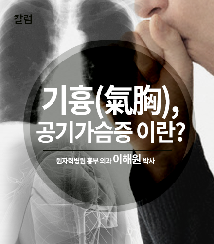 기흉(氣胸, 공기가슴증)이란? - 이해원 박사